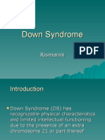 7.down Syndrome