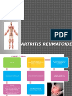 Artritis Reumatoide AHERO