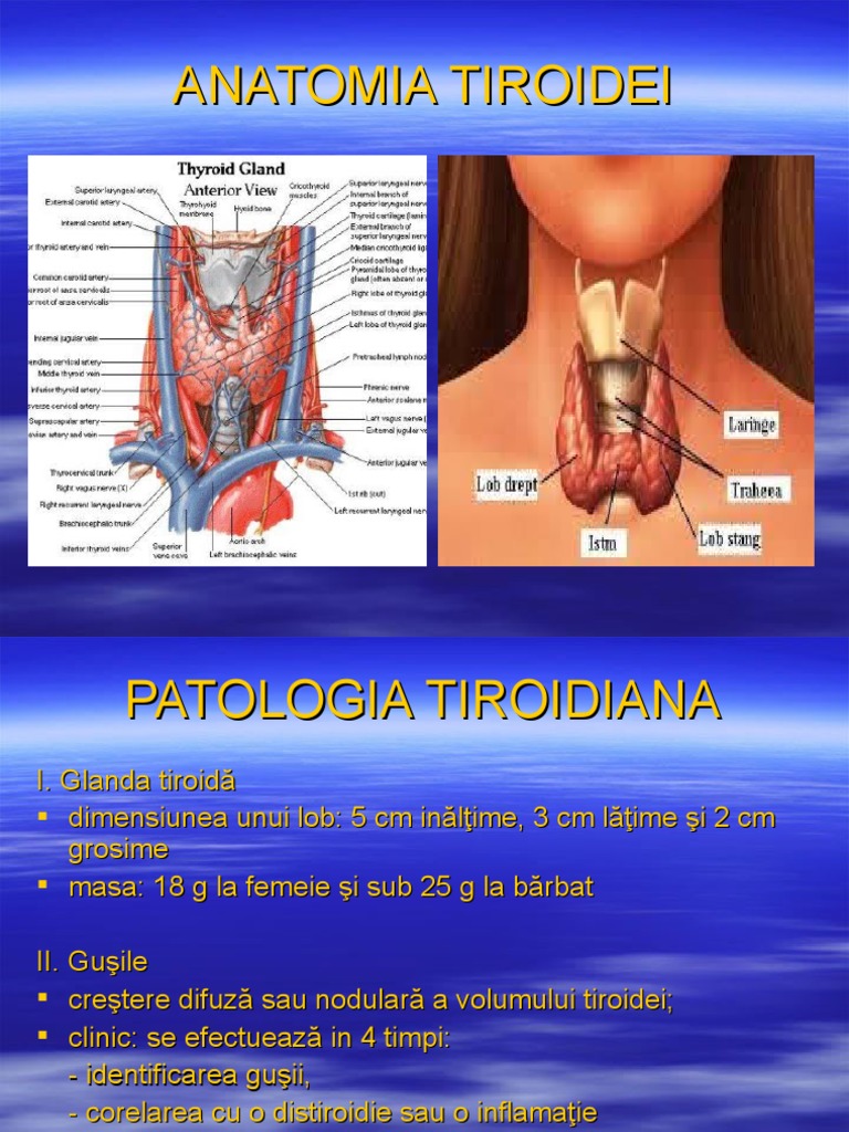 Tiroida