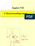 Electrocardiogram Me