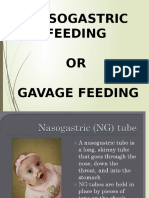 NG Feeding
