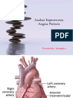 Angina Pectoris