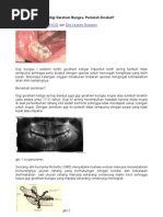 Download Pencabutan Gigi Geraham Bungsu by Dani Rudyanto SN35171627 doc pdf