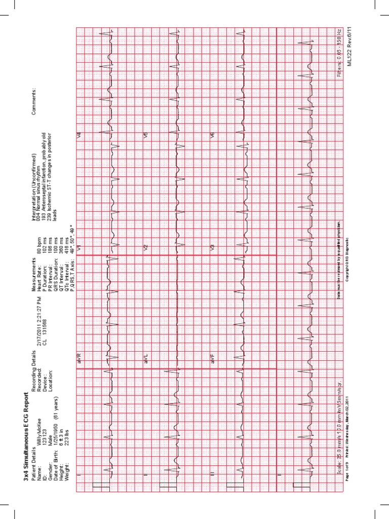 Ecg Sample Report Electrocardiography Cardiology