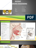 Referat CA Nasofaring