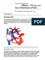 Patent Duktus Arteriosus