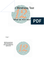 Color Blindness Test: What Do YOU See?