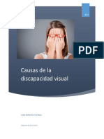 Causas de La Discapacidad Visual1