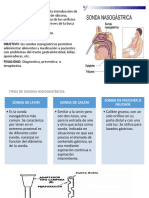 Sonda Nasogastrica