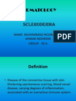 Scleroderma