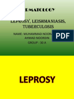 Leprosy