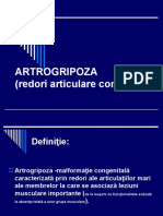 Artrogripoza