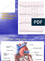 ekg-normalaritmiaima.ppt