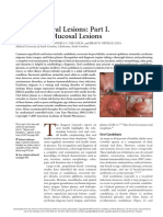 Common Oral Lesions: Part I. Superficial Mucosal Lesions 