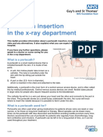 Having A Portcath Insertion