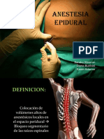 Anestesis Epidural