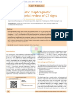 Blunt Traumatic Diaphragmatic Hernia: Pictorial Review of CT Signs