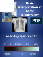 Basicinterpretationofcxr 110913060449 Phpapp01