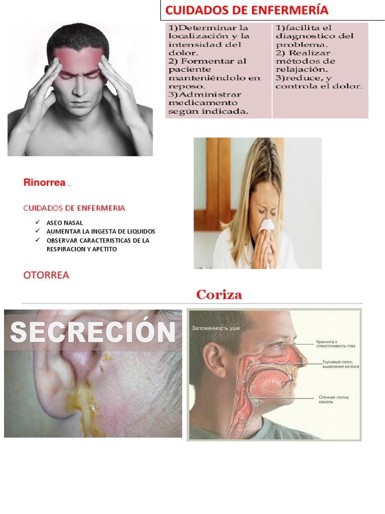 Rinorrea | PDF