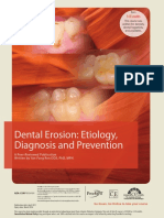 Dental Erosion PDF