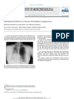 Hydropneumothorax in A Patient With Bullous Emphysema: Hidroneumotórax en Paciente Con Enfisema Bulloso