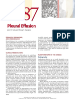 Pleural Effusion