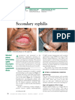 Secondary Syphilis