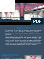 Frenectomia