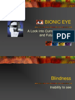 Bionic Eye: A Look Into Current Research and Future Prospects