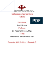 Melanomas en La Mucosa Oral