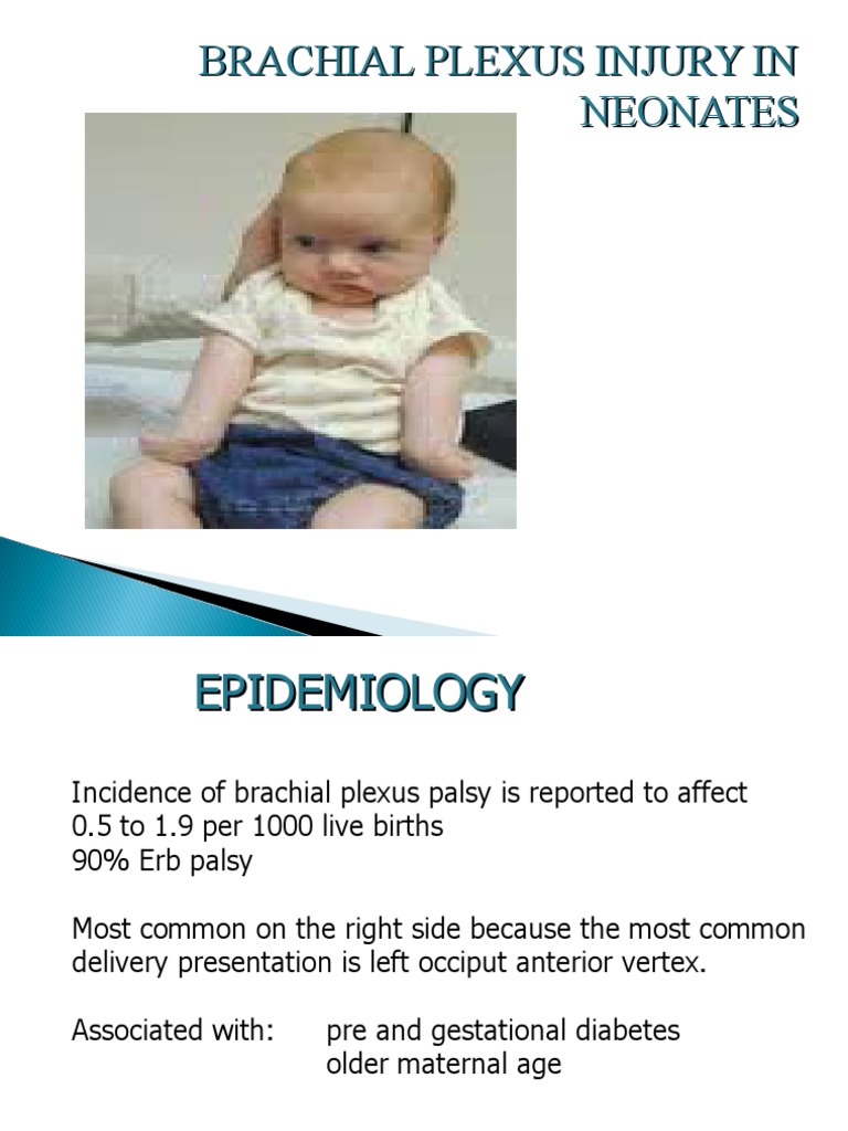 Neonatal Brachial Plexus Injury Guide | PDF | Limbs (Anatomy ...