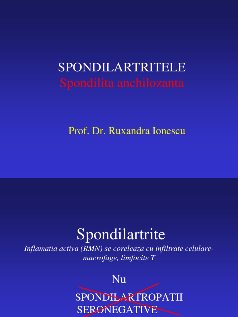 Spondilita: Cauze, Simptome & Tratament | CENTROKINETIC