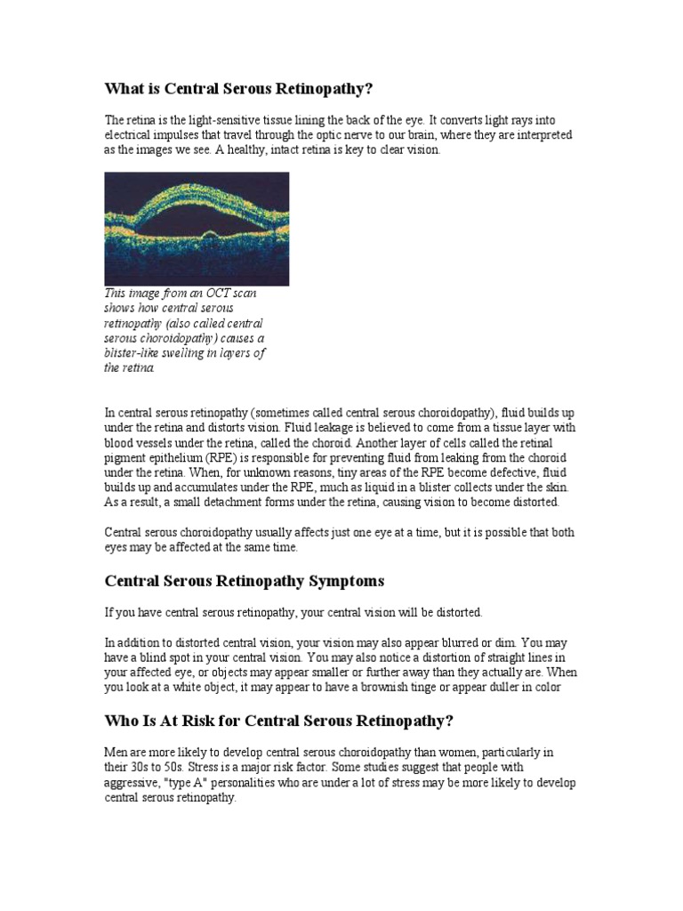 Understanding Central Serous Retinopathy | PDF | Retina | Epidemiology