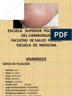 Caso Clinico Mastitis