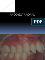 Arco Extraoral