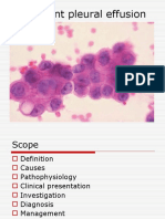 Malignant Pleural Effusion1