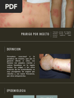 Prurigo Por Insectos | PDF | Enfermedades y trastornos | Dermatología