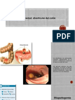 Enfermedad Diverticular Del Colón