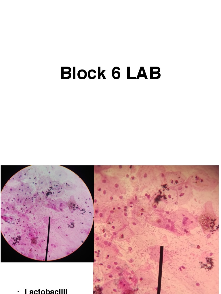 Gynecological and Breast Pathology Report | PDF