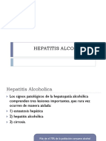 Hepatitis Alcohólica
