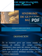 Sindrome de Guillain Barre