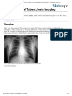 Gastrointestinal Tuberculosis Imaging: Chest Radiograph Reveals Calcified Hilar Tuberculous Lymphadenitis