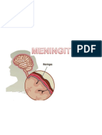 Meningitis