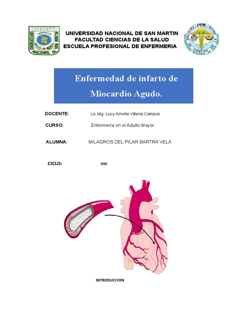 Intervención en Ruptura Miocárdica | PDF | Infarto de miocardio ...