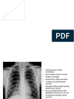 Pemeriksaan Radiografi Paru