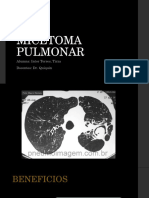 Micetoma Pulmonar