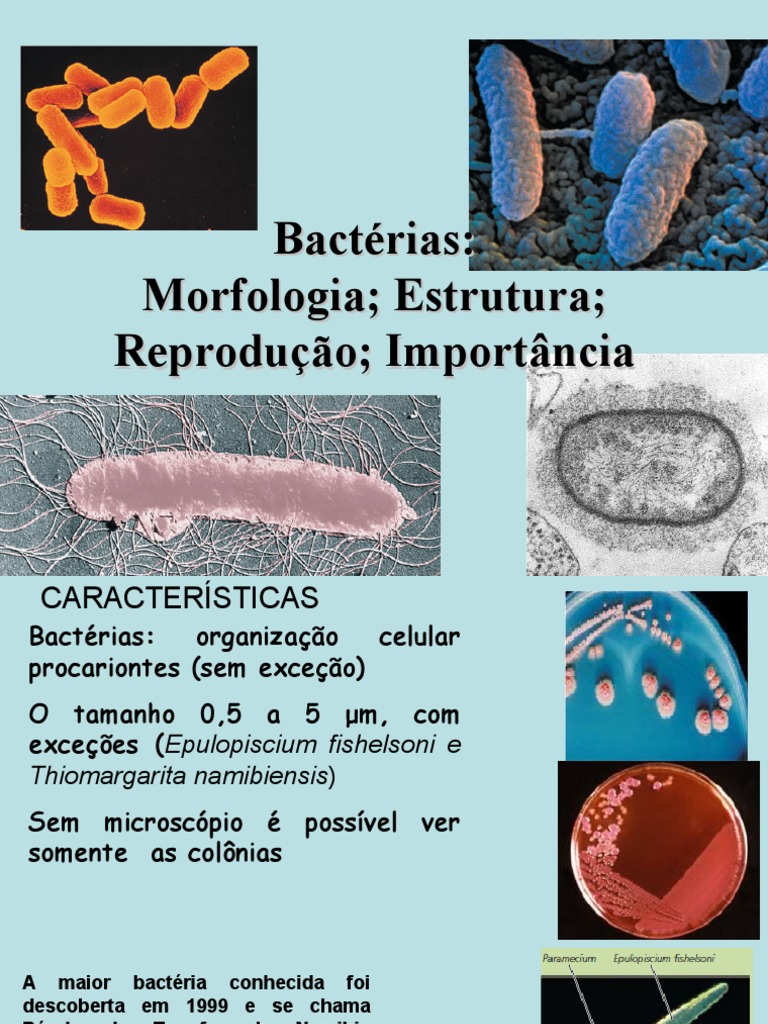 A Associação De Bacterias Em Forma De Virgula Denomina Se