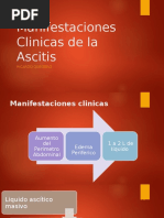 Manifestaciones Clinicas de La Ascitis
