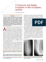 Humeral Shaft Fractures and Radial Palsy PDF