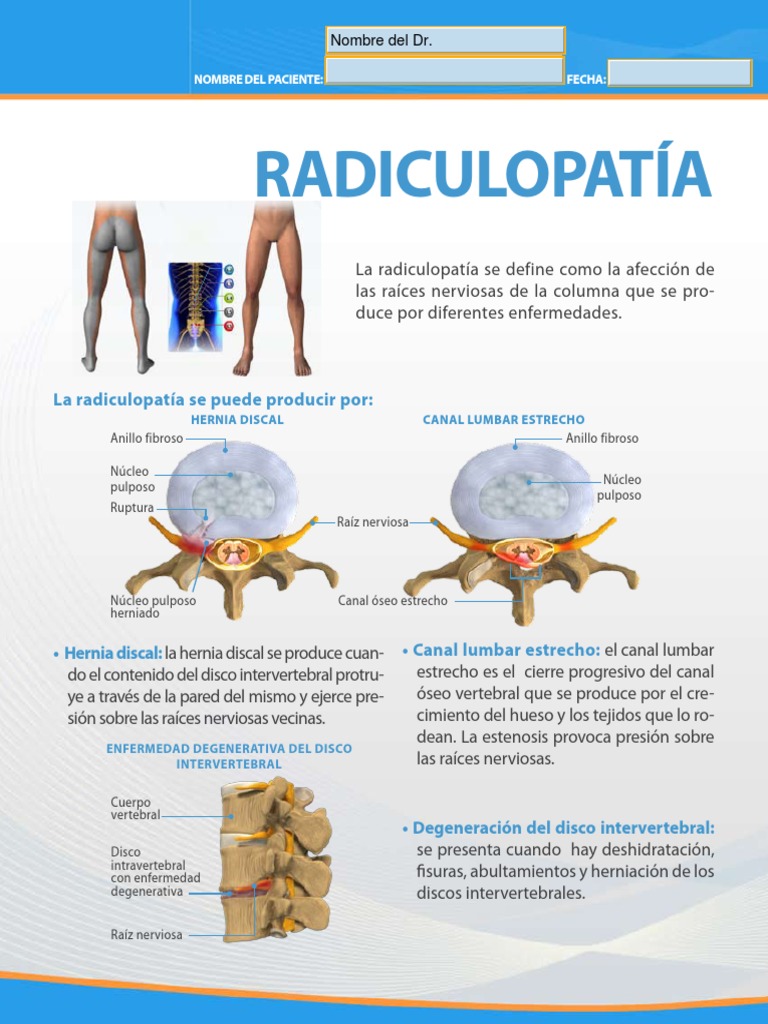 Radiculopatia | PDF | Anatomía de los primates | Sistema musculoesquelético
